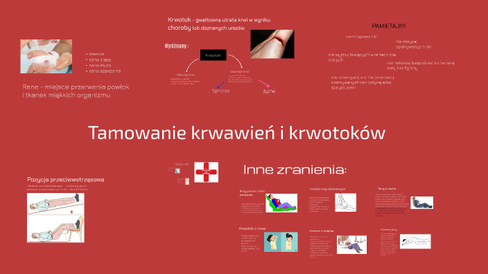 Tamowanie Krwawień I Krwotoków Edb Tamowanie krwawień i krwotoków by Matylda on Prezi