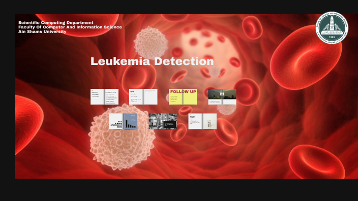 Stunning Ideas Leukemia Detection Home Remedy image