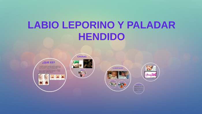 Labio Leporino Y Paladar Hendido By Diana Ruiz 8389