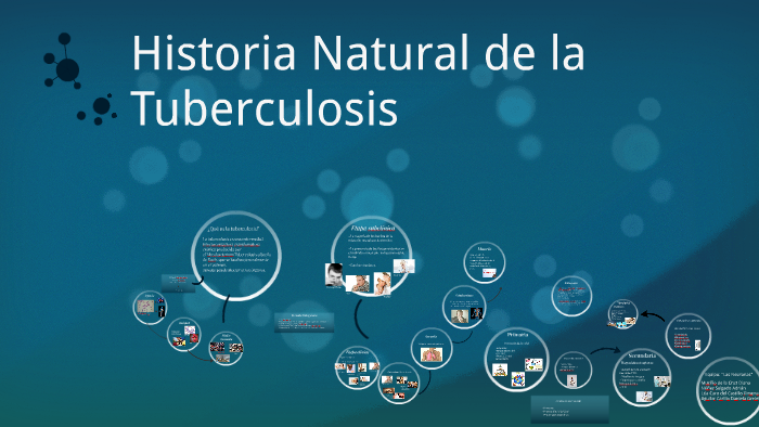 Historia Natural de la Tuberculosis by Diana Muciño on Prezi