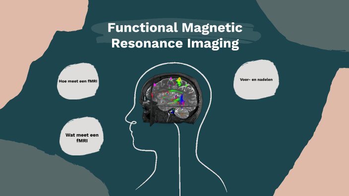 Functional Magnetic Resonance Imaging by Febe Houtenbos on Prezi