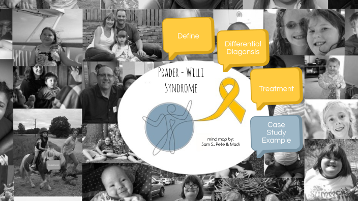 Stunning Portraits The Beauty And Strength Shown In Prader Willi Syndrome Pictures - pf4dvtm