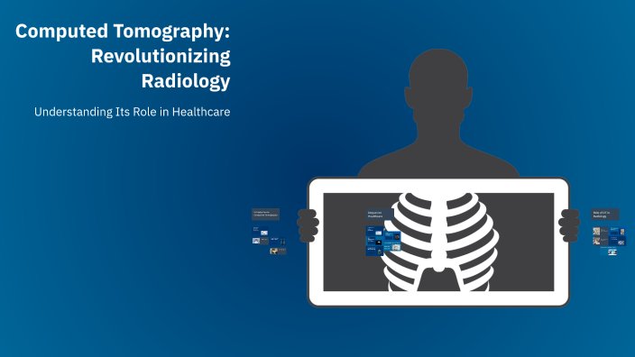 Computed Tomography: Revolutionizing Radiology by zari khalid on Prezi
