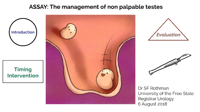 non-palpable-undescended-testis-by-sarel-rothman