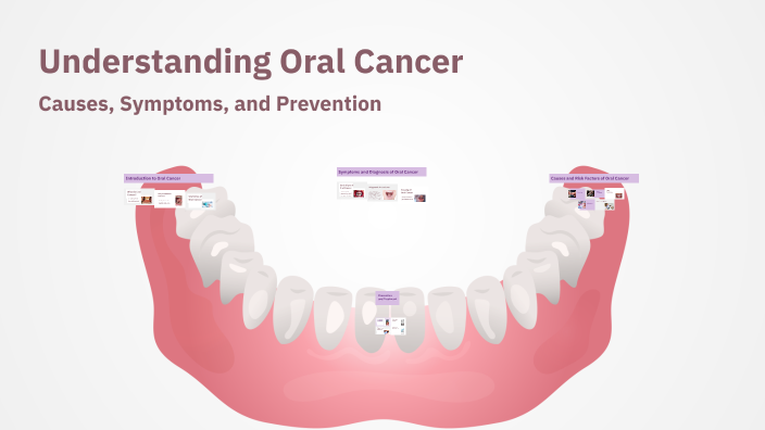 Understanding Oral Cancer by saleh bahasan on Prezi