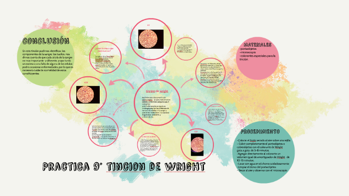 Practica 9° Tincion De Wright By Karen Morales On Prezi