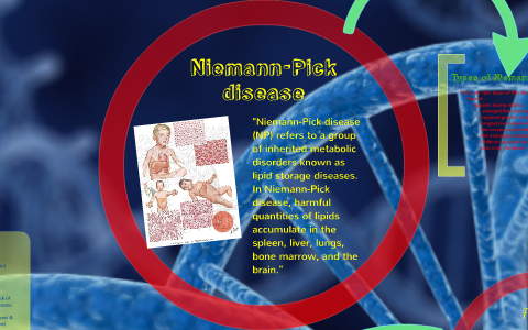 Niemann Pick Disease - an overview