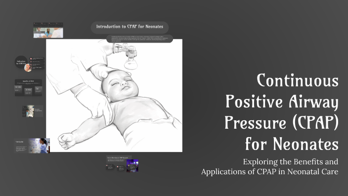 Continuous Positive Airway Pressure (CPAP) for Neonates by momo gaming ...