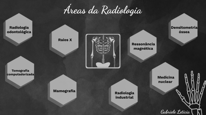 areas da Radiologia by Gabriele Da Silva on Prezi