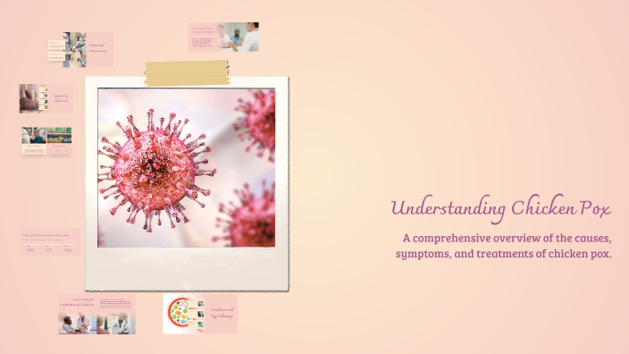 Understanding Chicken Pox by tulip neo on Prezi