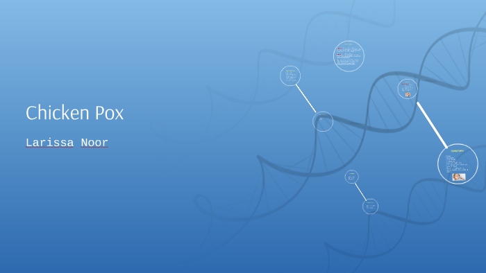 Chicken Pox by larissa noor on Prezi