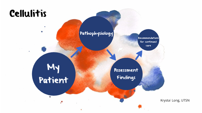 Concept Map Cellulitis By Krystal Long On Prezi 1649