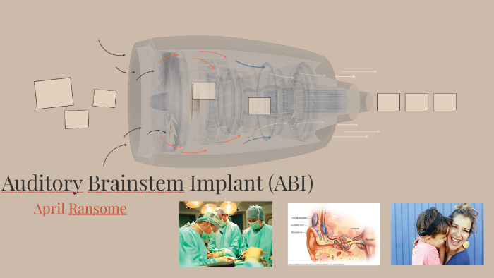 auditory brainstem implant