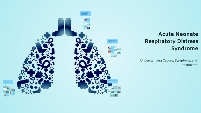 Acute Neonate Respiratory Distress Syndrome by Crisha Reykheyl Almazan ...