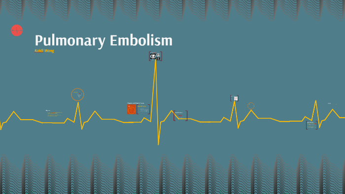 Pulmonary Embolism by Kerry wang