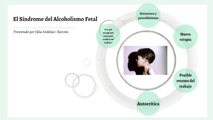 Síndrome Del Alcoholismo Fetal By Julia Andaluz 7154