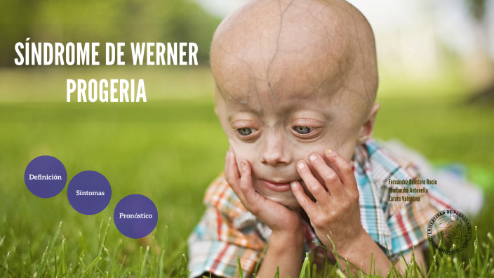 sindrome werner by valentina zarate on Prezi