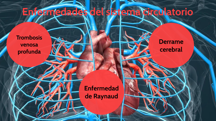 Enfermedades del sistema circulatorio by Mijael Cárdenas on Prezi