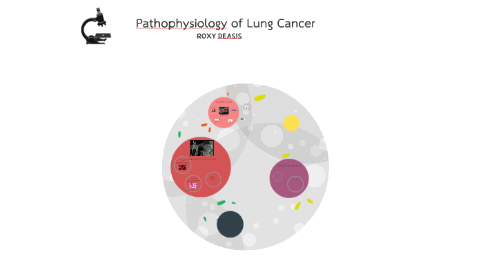 Pathophysiology of Lung Cancer by Roxanne De Asis on Prezi