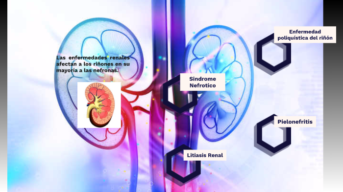 Fisiopatologia Renal by Geraldine Porras Martinez on Prezi