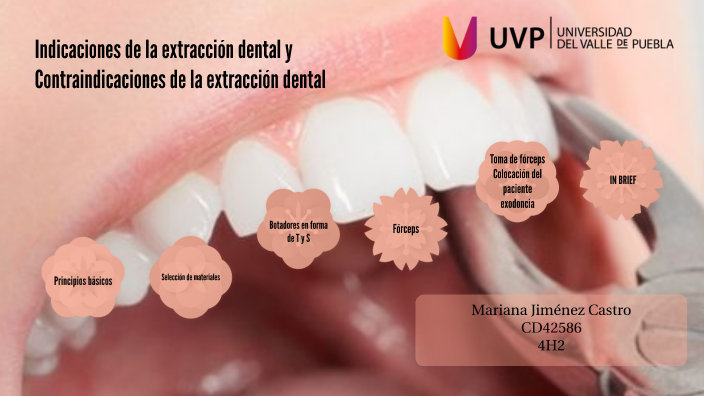 Indicaciones De La Extracción Dental. Contraindicaciones De La ...