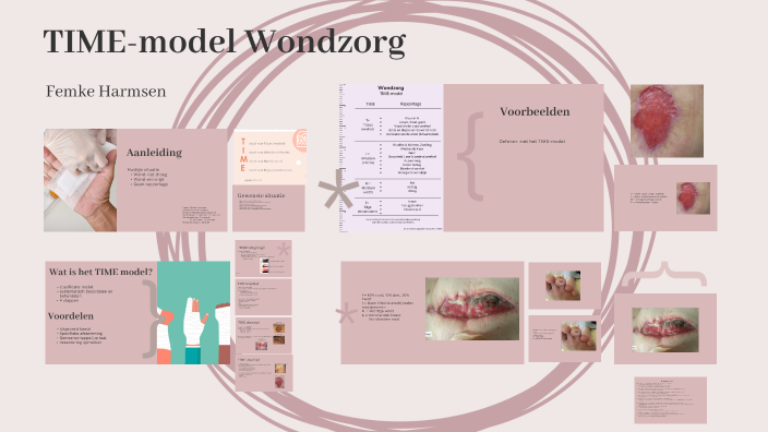 TIME-model Wondzorg by F Harmsen on Prezi