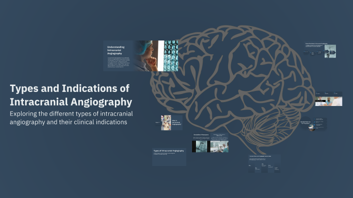 Types and Indications of Intracranial Angiography by Betül Görmüş on Prezi
