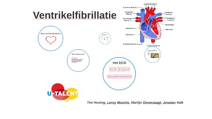 Ventrikelfibrillatie by tim honing on Prezi