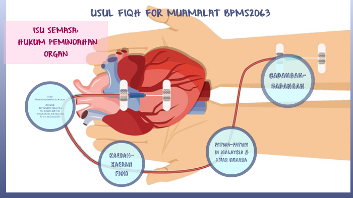 Isu Semasa Hukum Pemindahan Organ By Pipow Comel