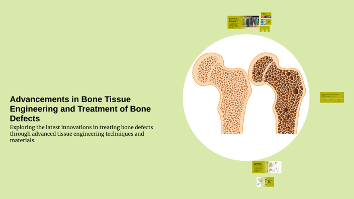 Advancements in Bone Tissue Engineering and Treatment of Bone Defects ...
