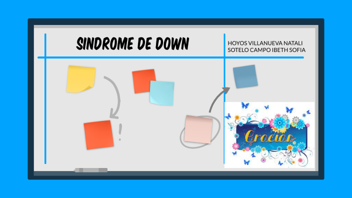 Sindrome de Down by ibeth sofia sotelo campo on Prezi