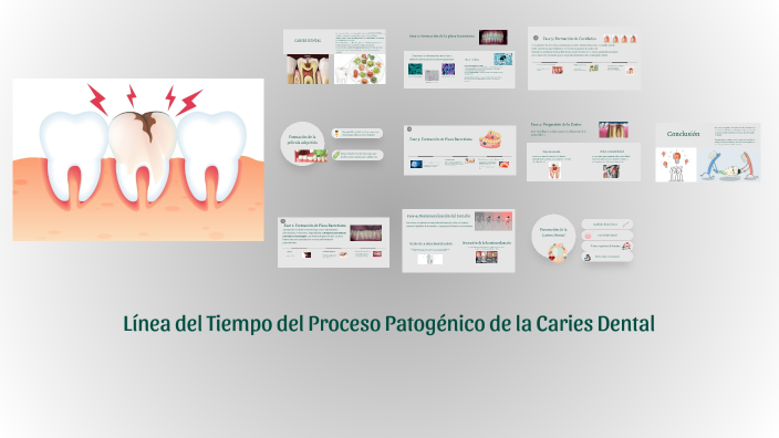 Pgh Linea Línea del Tiempo del Proceso Patogénico de la Caries Dental by Nekaa ...