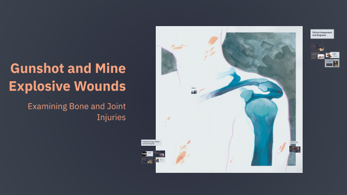 Gunshot and Mine Explosive Wounds by Navdeep Rana on Prezi
