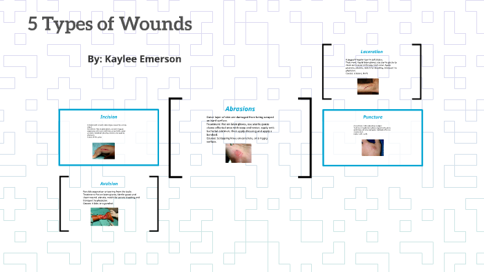 What Are 5 Types Of Wounds