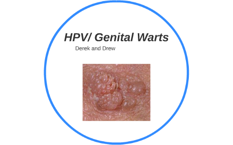 Can human papillomavirus cause genital warts