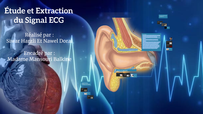 Étude et Extraction du Signal ECG by Harzli siwar on Prezi