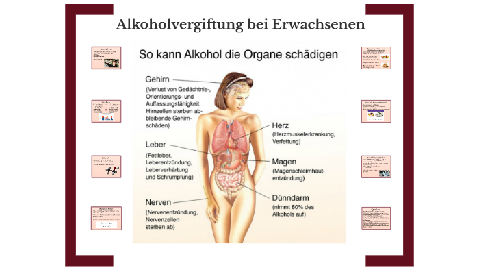 Alkoholvergiftung Bei Betroffenen Erwachsenen Ab 16 By Ingeborg