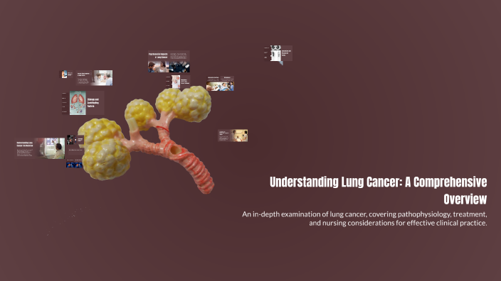 Understanding Lung Cancer: A Comprehensive Overview by Vanshita on Prezi