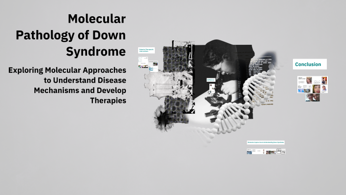 Molecular Pathology Of Down Syndrome By Mohammed Amri On Prezi