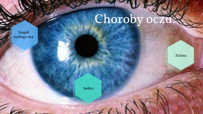 Choroby Oczu By Amelia Anazta On Prezi 1939