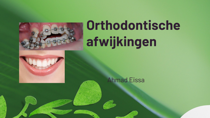 orthodontische afwijkingen by A10 E7 on Prezi