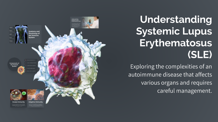 Sle System Understanding Systemic Lupus Erythematosus (SLE) by Mohamed Adel on Prezi