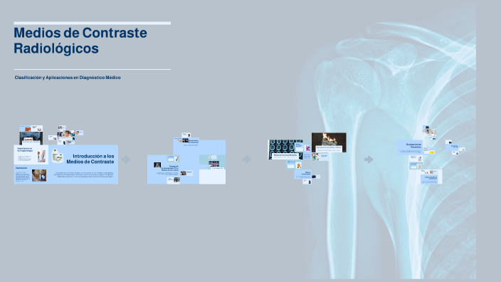 Medios de Contraste Radiológicos by ALEXANDER BLANCO CARREÑO on Prezi