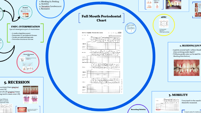 Full Mouth Periodontal Charting