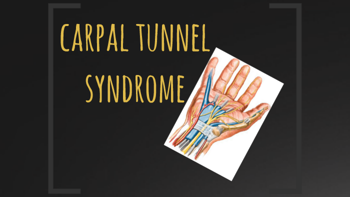 CTS syndrome by S . A . H SHAER on Prezi