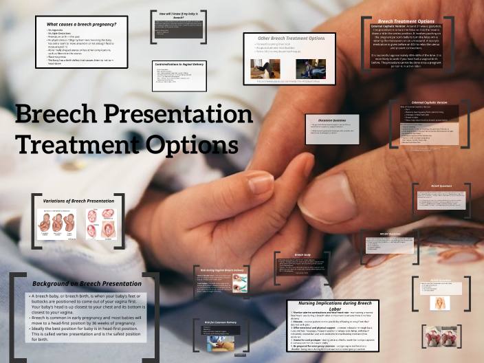 breech presentation homeopathic medicine