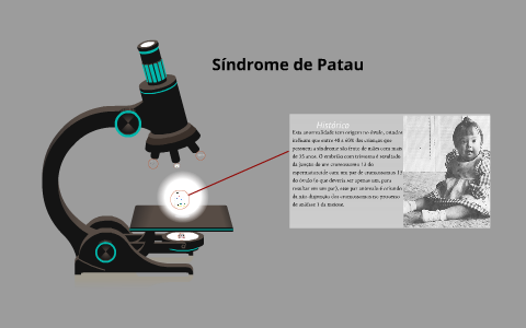 Descoberta em 1960 por Klaus Patau. by Walisson Souza on Prezi