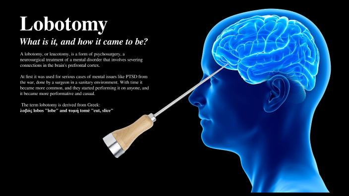 History of lobotomy by Michaela Mike ov 225 on Prezi