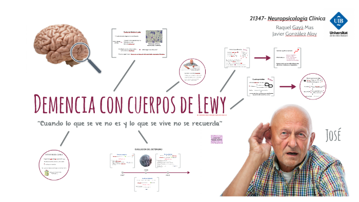 Demencia Con Cuerpos De Lewy By Raquel Gayá On Prezi 3114