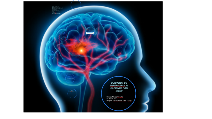 CUIDADOS DE ENFERMERIA AL PACIENTE CON ICTUS by Mónica MC on Prezi
